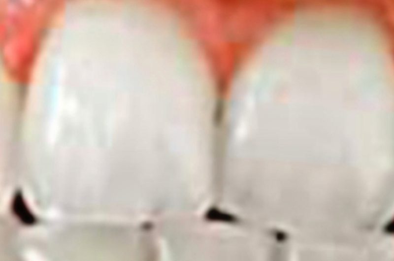 3 minute natural teeth whitening at home a simple diy recipe for brighter smiles