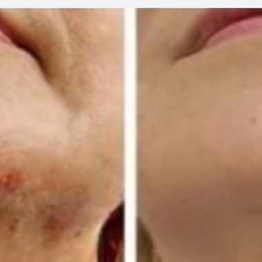 bay leaf anti aging tonic natural skincare for youthful glowing skin