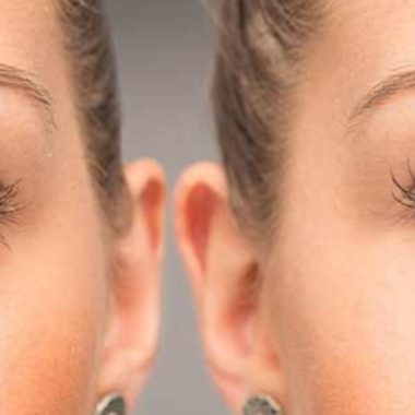 castor oil for eye health natural remedies for dry eyes eye bags and more