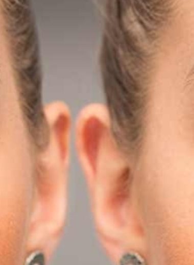 castor oil for eye health natural remedies for dry eyes eye bags and more