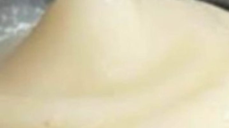 diy rice water facelift mask instant skin tightening and anti aging remedy