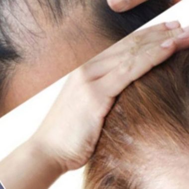 grandmas secret flax seed hair growth gel recipe boost hair health naturally