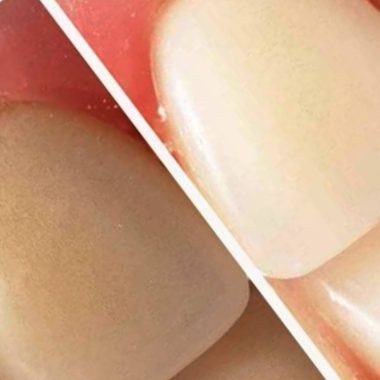grandmas secret to a brighter smile natural teeth whitening with baking soda