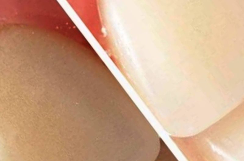 grandmas secret to a brighter smile natural teeth whitening with baking soda