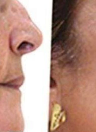 how to naturally fade age spots with baking soda a simple diy remedy