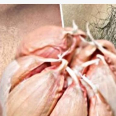 how to permanently get rid of facial body and pubic hair naturally 3 powerful diy remedies