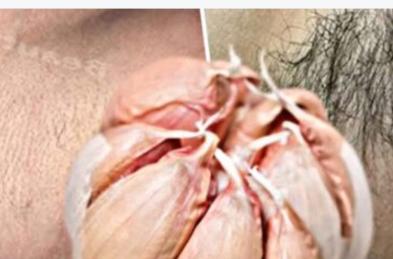 how to permanently get rid of facial body and pubic hair naturally 3 powerful diy remedies