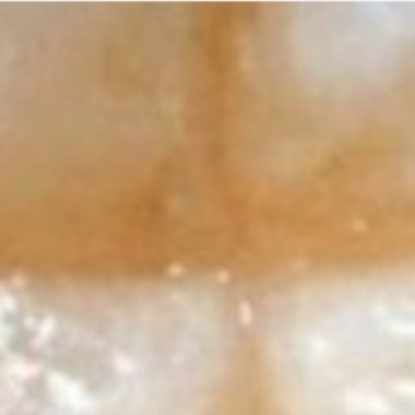 natural dental health prevent cavities with a balanced diet and smart food choices