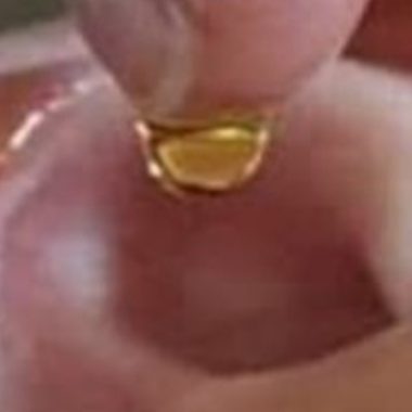 natural ear drops recipe restore your hearing with this simple home remedy