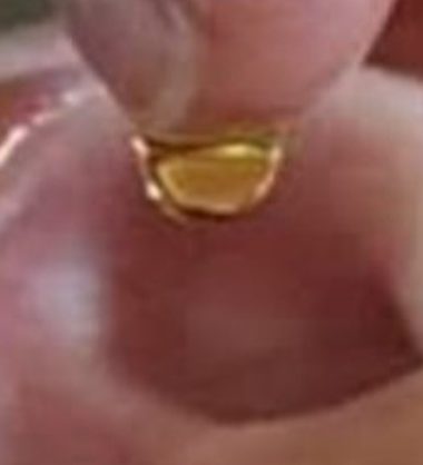 natural ear drops recipe restore your hearing with this simple home remedy