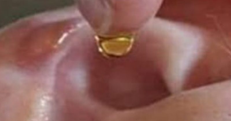 natural ear drops recipe restore your hearing with this simple home remedy