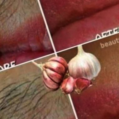 natural hair removal with garlic a safe affordable and effective solution