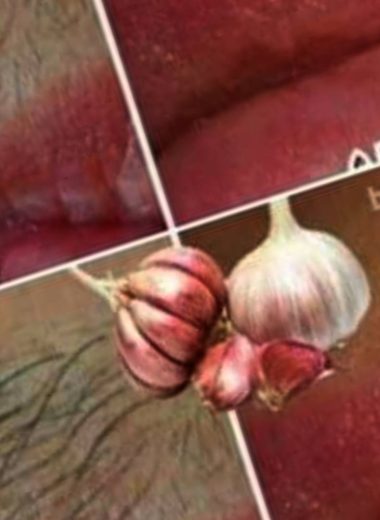 natural hair removal with garlic a safe affordable and effective solution