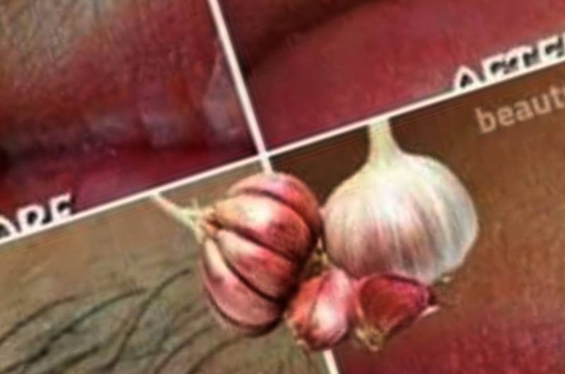 natural hair removal with garlic a safe affordable and effective solution