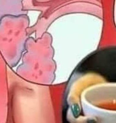 natural phlegm remover syrup relieve cough flu and sinusitis with this powerful home remedy