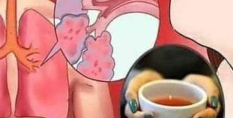 natural phlegm remover syrup relieve cough flu and sinusitis with this powerful home remedy