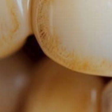 natural ways to remove tartar and whiten teeth at home dentist approved tips