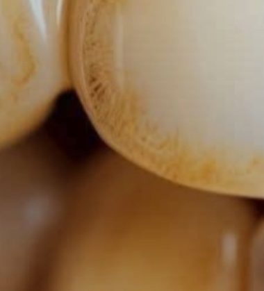 natural ways to remove tartar and whiten teeth at home dentist approved tips