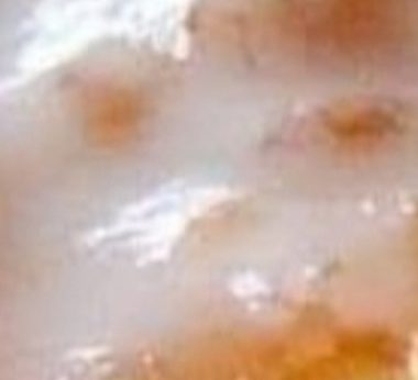 perfect amish apple fritter recipe crispy sweet and irresistible