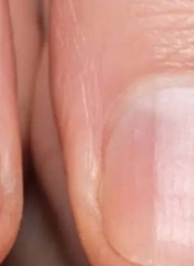 striped nails what they could reveal about your health
