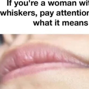 understanding chin whiskers in women health insights and solutions