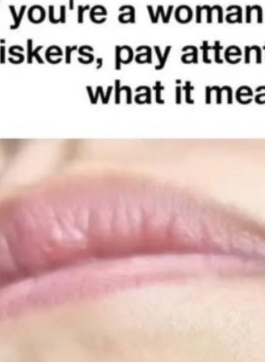 understanding chin whiskers in women health insights and solutions
