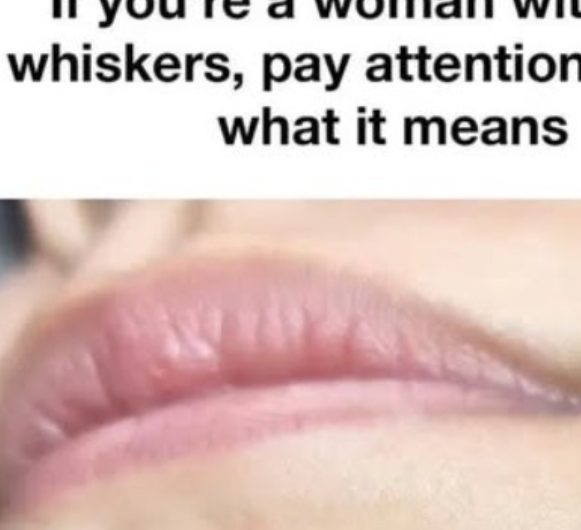 understanding chin whiskers in women health insights and solutions